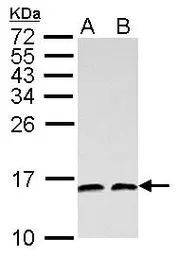 Anti-NHP2L1 antibody [N1C3] used in Western Blot (WB). GTX109247
