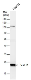 Anti-GSTT1 antibody used in Western Blot (WB). GTX109250