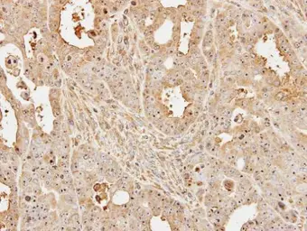 Anti-UBE2D1 antibody used in IHC (Paraffin sections) (IHC-P). GTX109257