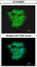 Anti-UBE2D1 antibody used in Immunocytochemistry/ Immunofluorescence (ICC/IF). GTX109257