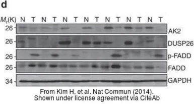 Anti-DUSP26 antibody [N1C1] used in Western Blot (WB). GTX109283