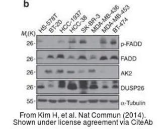 Anti-DUSP26 antibody [N1C1] used in Western Blot (WB). GTX109283