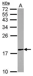 Anti-DUSP26 antibody [N1C1] used in Western Blot (WB). GTX109283