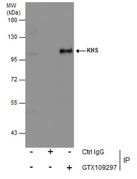 Anti-KHS antibody [N3C1], Internal used in Immunoprecipitation (IP). GTX109297