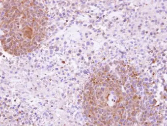 Anti-KHS antibody [N3C1], Internal used in IHC (Paraffin sections) (IHC-P). GTX109297