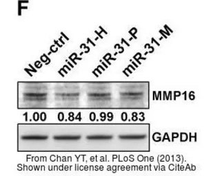 Anti-MMP16 antibody used in Western Blot (WB). GTX109378