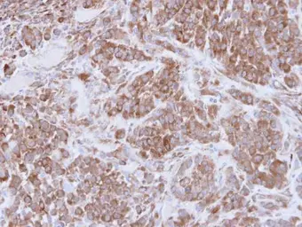Anti-MMP16 antibody used in IHC (Paraffin sections) (IHC-P). GTX109378