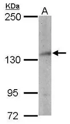 Anti-NSD3 antibody [C1C2], Internal used in Western Blot (WB). GTX109396