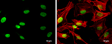 Anti-NSD3 antibody [C1C2], Internal used in Immunocytochemistry/ Immunofluorescence (ICC/IF). GTX109396