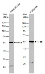 Anti-FYN antibody [N1C2] used in Western Blot (WB). GTX109428