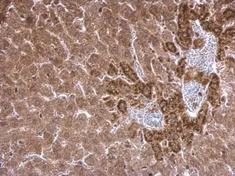 Anti-SCAP antibody [C2C3], C-term used in IHC (Paraffin sections) (IHC-P). GTX109474