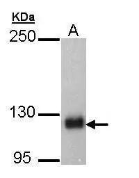 Anti-SCAP antibody [C2C3], C-term used in Western Blot (WB). GTX109474