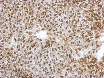 Anti-NFYA antibody used in IHC (Paraffin sections) (IHC-P). GTX109511