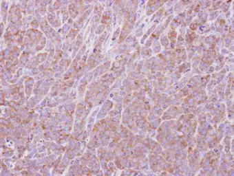 Anti-EIF2B1 antibody used in IHC (Paraffin sections) (IHC-P). GTX109525
