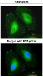 Anti-beta A4 Crystallin antibody [N1C3-2] used in Immunocytochemistry/ Immunofluorescence (ICC/IF). GTX109526
