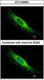 Anti-PEX26 antibody used in Immunocytochemistry/ Immunofluorescence (ICC/IF). GTX109551