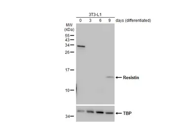 Anti-Resistin antibody [N1C3] used in Western Blot (WB). GTX109562
