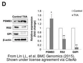 Anti-Proteasome 20S beta 3 antibody [N1C3] used in Western Blot (WB). GTX109566
