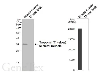 Anti-Troponin T1 (slow) skeletal muscle antibody used in Western Blot (WB). GTX109585