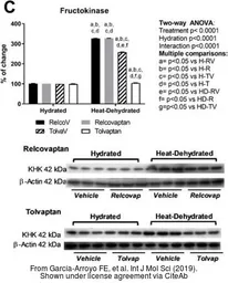 Anti-Ketohexokinase antibody [N1C3] used in Western Blot (WB). GTX109591
