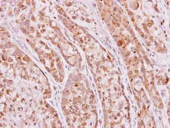 Anti-Ketohexokinase antibody [N1C3] used in IHC (Paraffin sections) (IHC-P). GTX109591