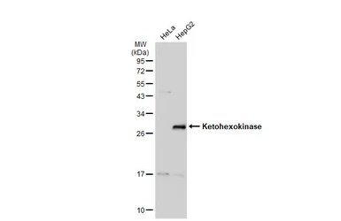 Anti-Ketohexokinase antibody [N1C3] used in Western Blot (WB). GTX109591