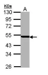 Anti-PSMC3 antibody [N1C2] used in Western Blot (WB). GTX109605