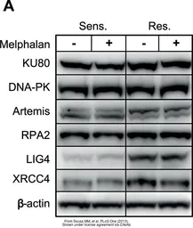 Anti-XRCC4 antibody used in Western Blot (WB). GTX109632