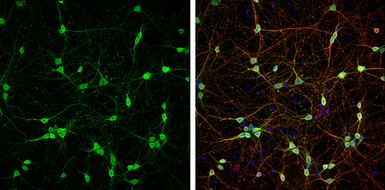 Anti-PGP9.5 antibody used in Immunocytochemistry/ Immunofluorescence (ICC/IF). GTX109637