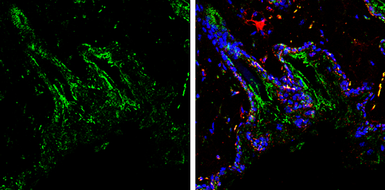 Anti-PGP9.5 antibody used in IHC (Paraffin sections) (IHC-P). GTX109637