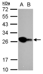 Anti-PGP9.5 antibody used in Western Blot (WB). GTX109637