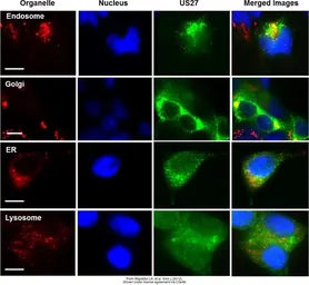 Anti-EEA1 antibody [C3], C-term used in Immunocytochemistry/ Immunofluorescence (ICC/IF). GTX109638