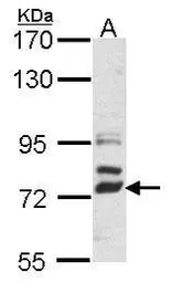 Anti-DLL4 antibody [N1N2], N-term used in Western Blot (WB). GTX109649