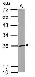 Anti-RAB5A antibody used in Western Blot (WB). GTX109665