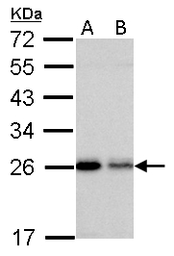 Anti-RAB5A antibody used in Western Blot (WB). GTX109665