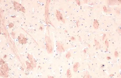 Anti-RAB5A antibody used in IHC (Paraffin sections) (IHC-P). GTX109665
