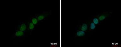 Anti-PHOX2B antibody used in Immunocytochemistry/ Immunofluorescence (ICC/IF). GTX109677