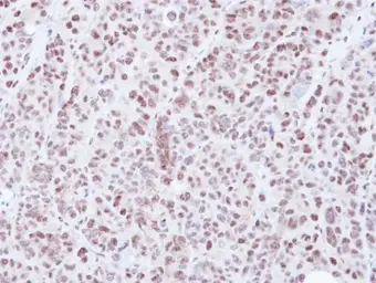 Anti-HDAC3 antibody [C3], C-term used in IHC (Paraffin sections) (IHC-P). GTX109679