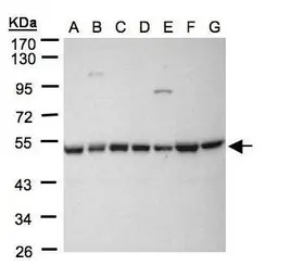 Anti-HDAC3 antibody [C3], C-term used in Western Blot (WB). GTX109679