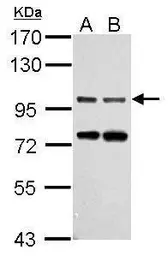 Anti-Gephyrin antibody [N2C1], Internal used in Western Blot (WB). GTX109734