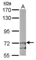Anti-EIF2B epsilon antibody used in Western Blot (WB). GTX109799