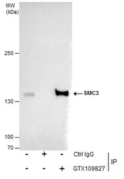 Anti-SMC3 antibody [N1N2], N-term used in Immunoprecipitation (IP). GTX109827