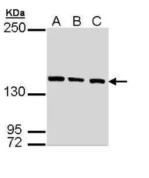 Anti-SMC3 antibody [N1N2], N-term used in Western Blot (WB). GTX109827