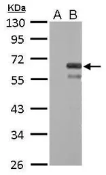 Anti-Factor X antibody used in Western Blot (WB). GTX109830