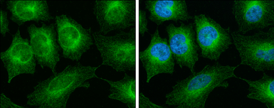 Anti-alpha Tubulin 1A antibody used in Immunocytochemistry/ Immunofluorescence (ICC/IF). GTX109832