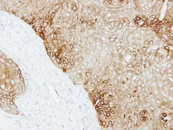Anti-Cytokeratin 13 antibody used in IHC (Paraffin sections) (IHC-P). GTX109883
