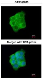 Anti-Cytokeratin 13 antibody used in Immunocytochemistry/ Immunofluorescence (ICC/IF). GTX109883