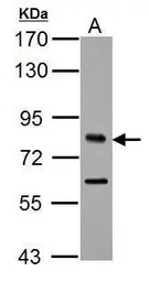 Anti-TCF3 / E2A antibody used in Western Blot (WB). GTX109885