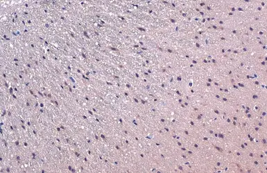 Anti-TCF3 / E2A antibody used in IHC (Paraffin sections) (IHC-P). GTX109885