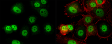 Anti-O-GlcNAc transferase antibody used in Immunocytochemistry/ Immunofluorescence (ICC/IF). GTX109939